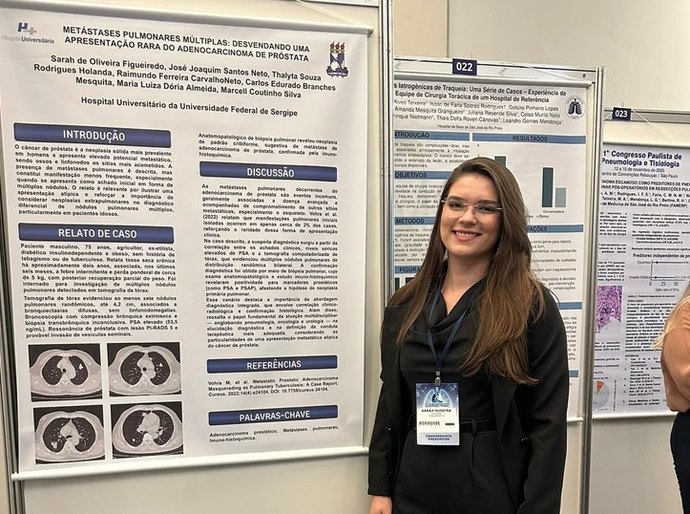 Residente do HU-UFS é a única brasileira selecionada para curso intensivo internacional de Pneumologia