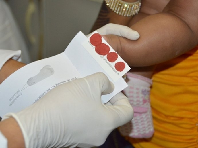 Sesau orienta técnicos municipais sobre importância do Teste do Pezinho