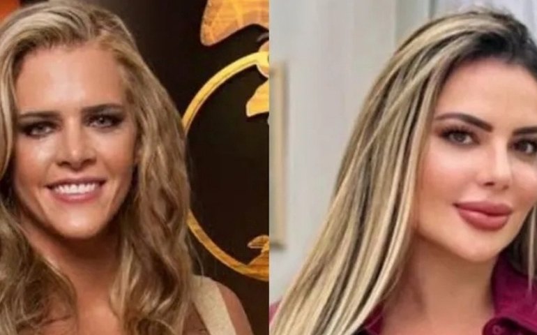 Como Denise Rocha, confira outras famosas que também fizeram cirurgia íntima