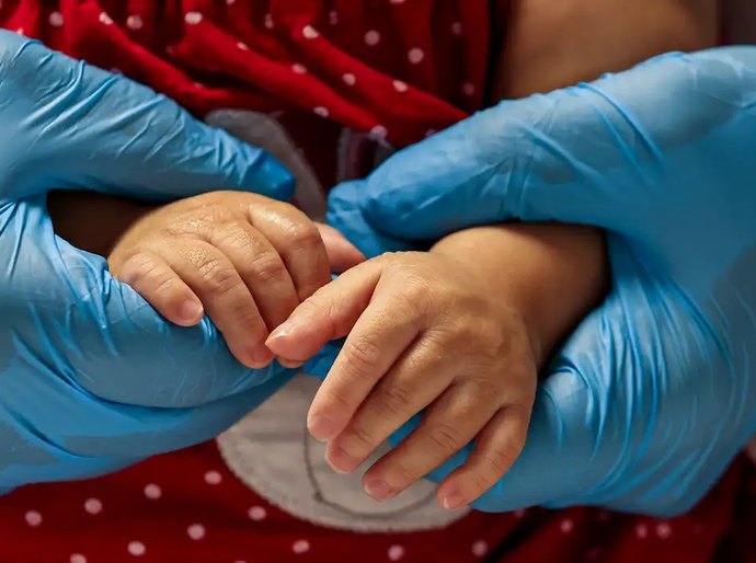 SUS passa a oferecer tratamento inovador de atrofia muscular espinhal
