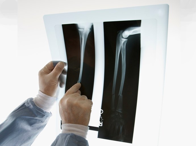 Hospital deve custear tratamento de criança com bisturi esquecido no braço