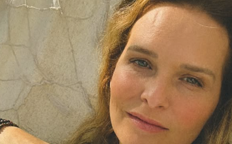 Fernanda Rodrigues diz que câncer de pele voltou e faz alerta para seguidores