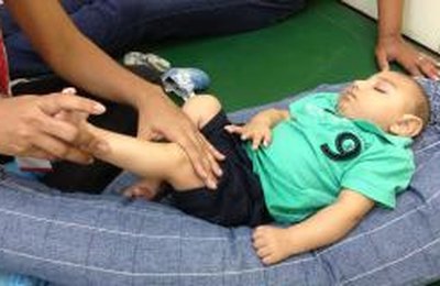Brasil registra 1.434 casos de bebês com microcefalia