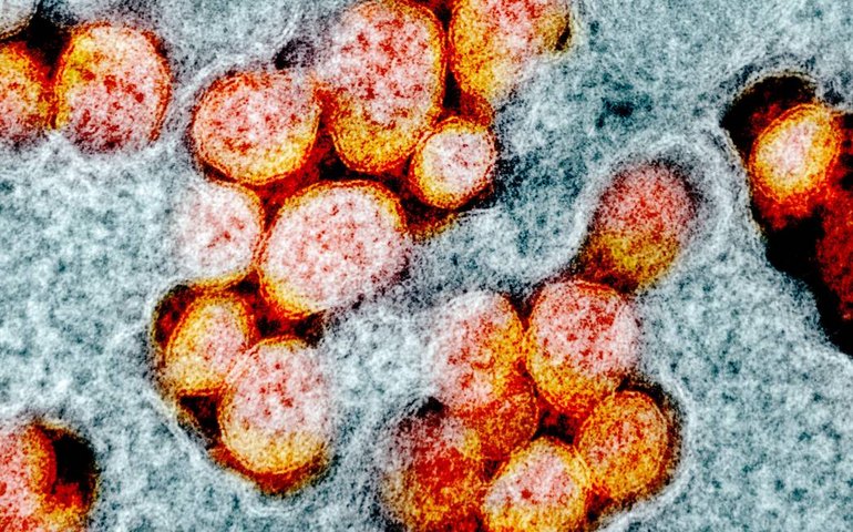 Ômicron terá efeitos distintos sobre empresas de saúde na bolsa