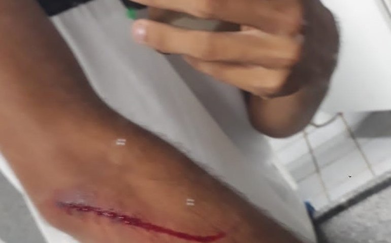 Aluno é ferido por colega dentro de escola, em Olho D’Água Grande