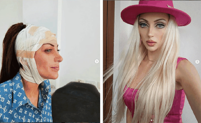 Bárbara Jankavski passou por diversas cirurgias para ser conhecida como 'Barbie humana'