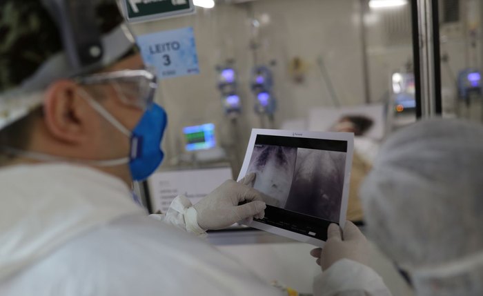 Pandemia elevou a demanda por exame de tomografia no estado