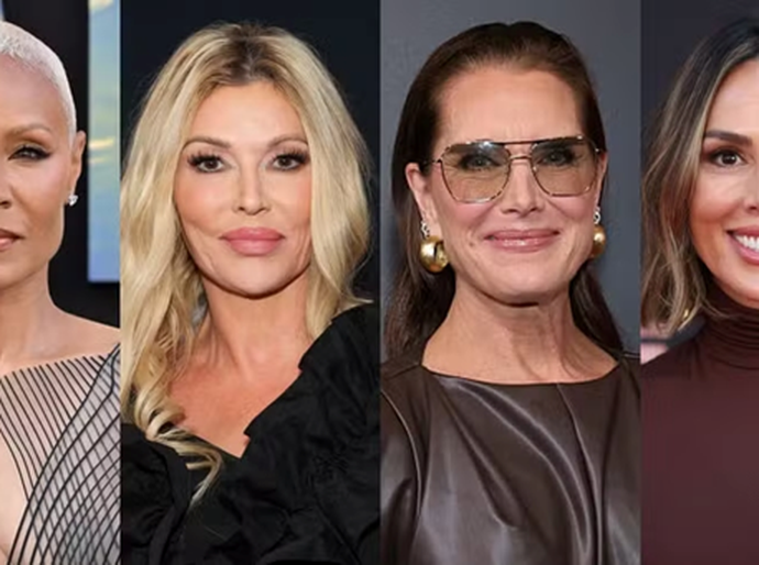 Divórcio, autoestima e autocuidado: os motivos que levaram famosas a recorrer à harmonização íntima