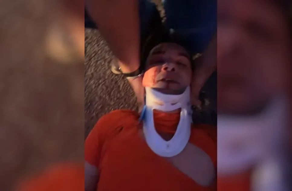 Cantor gospel Regis Danese sofre acidente e grava vídeo sangrando: 'estou com muita dor no abdômen'