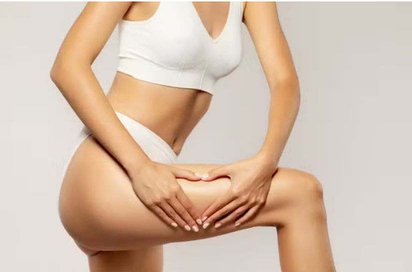 Cirurgia plástica pode piorar a celulite? Médica explica o efeito colateral pouco discutido