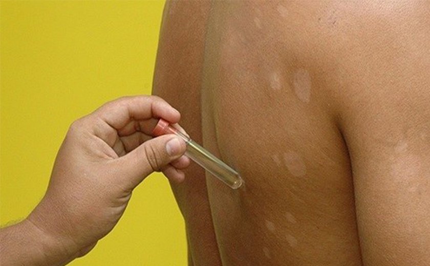 Vírus são mais perigosos de manhã do que à noite, diz estudo