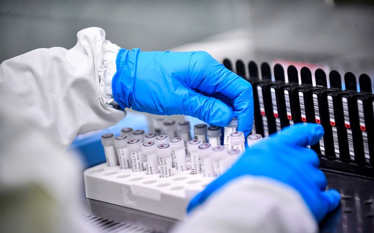 Entenda a diferença entre os testes para a Covid-19