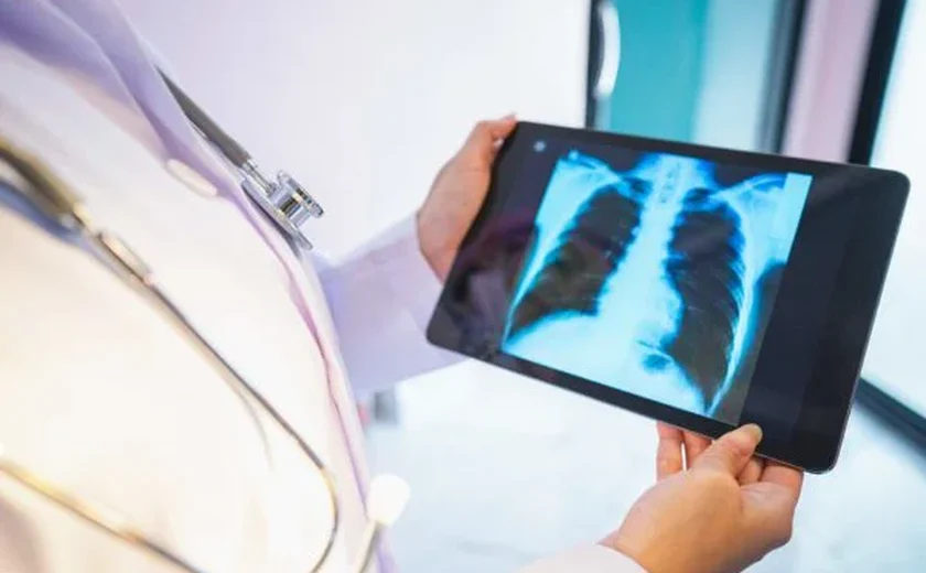 Tuberculose: novos exames e tratamentos modernizam combate à doença