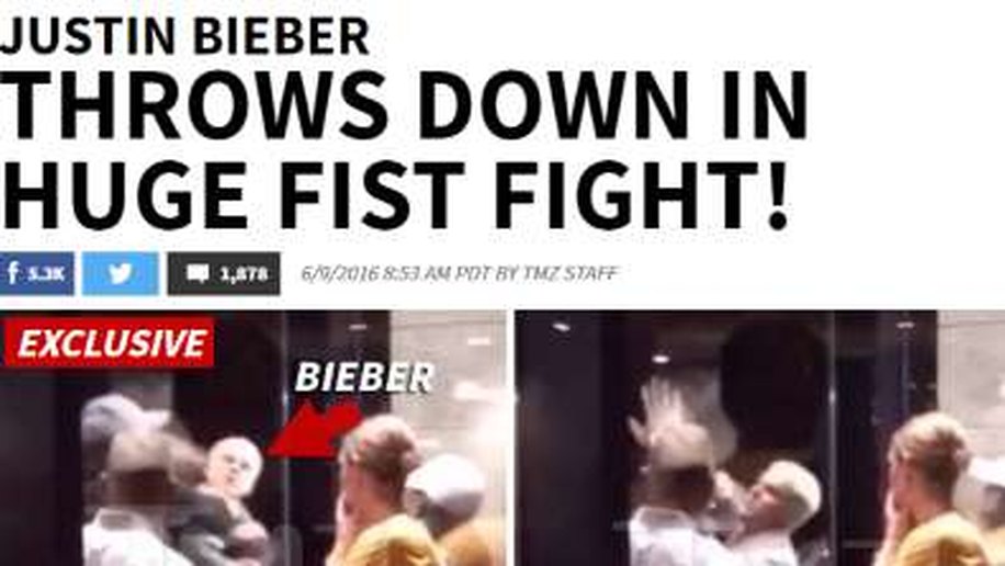 Justin Bieber leva a pior em briga com desconhecido em hotel