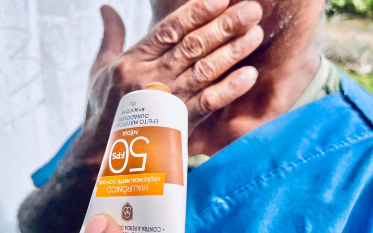 Médico do Hospital Ib Gatto alerta para a importância do diagnóstico precoce do câncer de pele