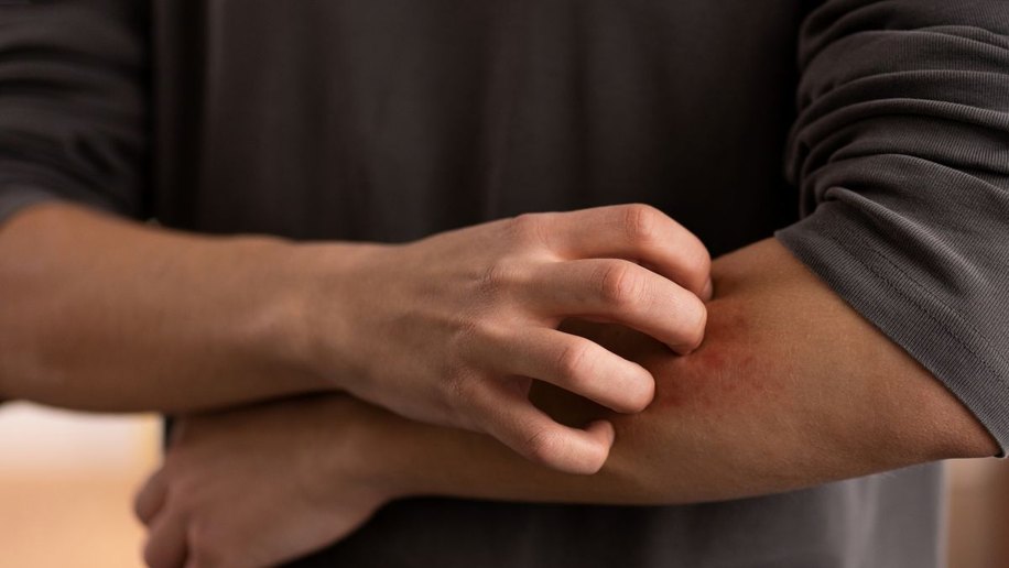 Dermatologista alerta que sinais na pele podem revelar doenças sistêmicas