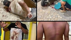 agressao-boate-portugal-10082022190737343 / Foto: REPRODUÇÃO FACEBOOK/GISLAINE ROSA