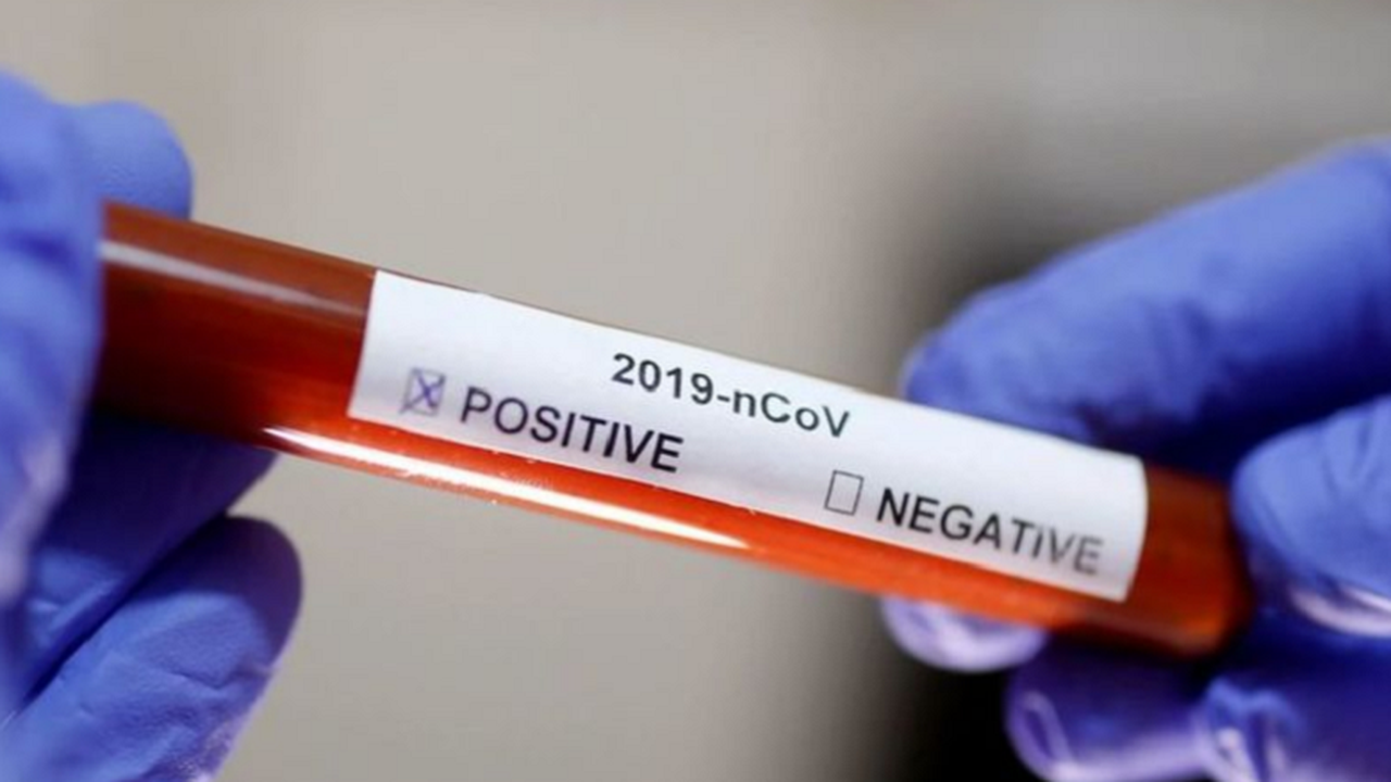 Brasil registra 22.169 casos confirmados de Covid-19 e 1.223 mortes pela doença