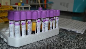 DOAÇÃO DE SANGUE HEMOSE / Foto: Ascom/SES