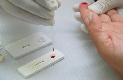 Julho Amarelo: campanha alerta para importância da testagem para hepatites virais, em Arapiraca