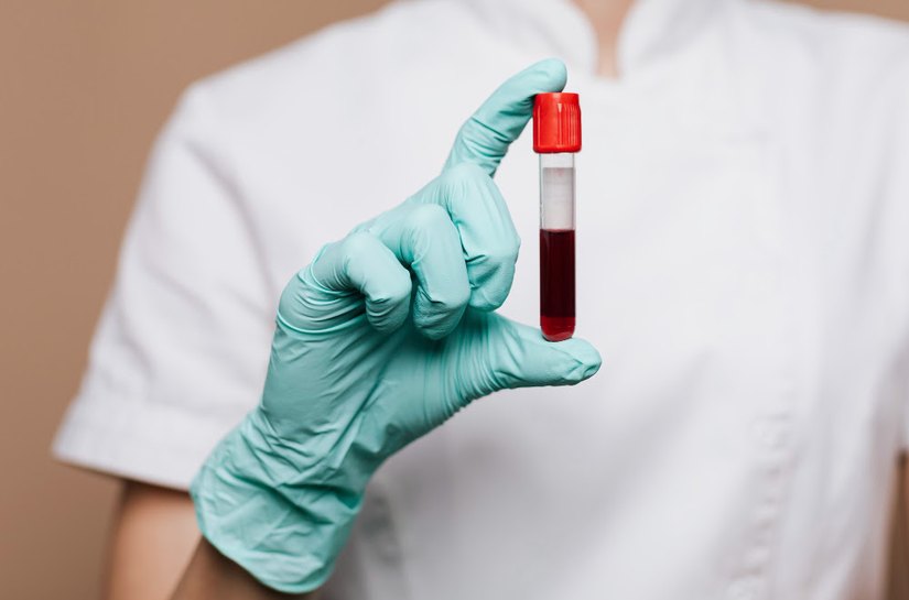 Startup usa IA para interpretar 20 mil hemogramas em busca de doenças graves no sertão pernambucano