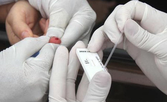 Metodologia usada na testagem é a punção digital