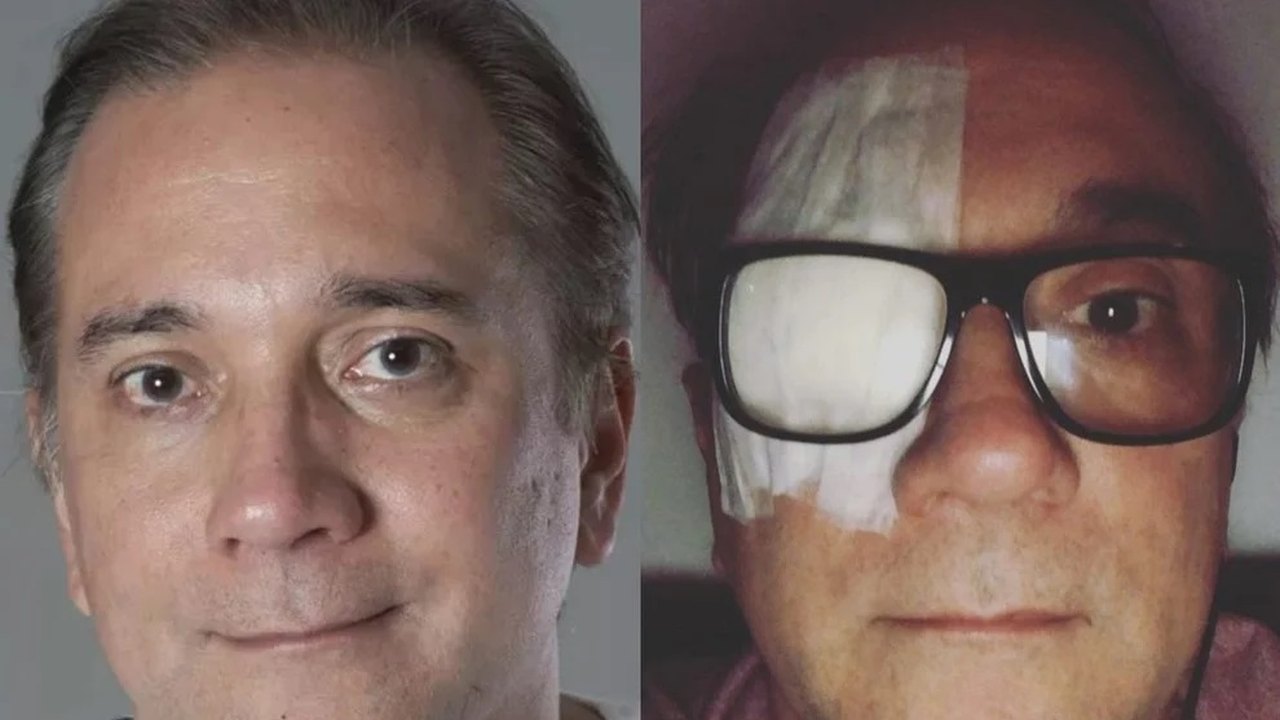 Vocalista do Biquíni Cavadão faz cirurgia para retirar tumor maligno