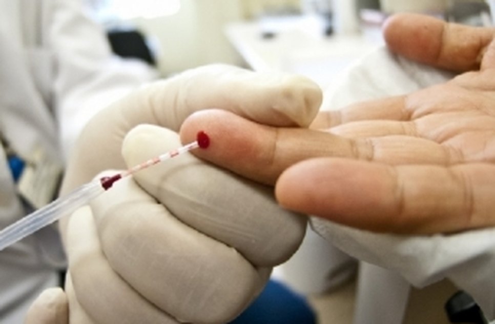 teste-sangue-HIV-aids--eex5p2615413-f3.jpg