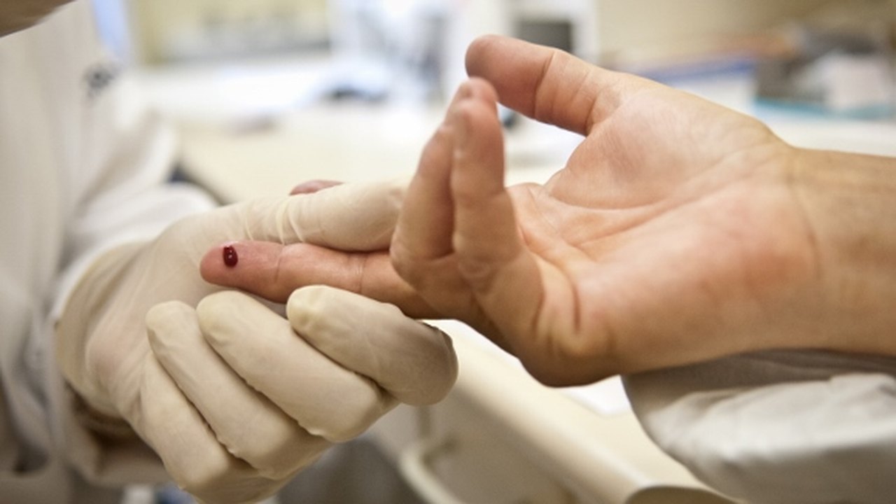 Covid-19: Mais de 80 mil profissionais da saúde testam positivo, com 169 mortos