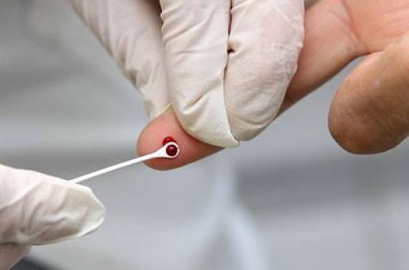 Por meio do Cespi, Palmeira realiza mais de 1.800 testes rápidos para identificar Hepatites B e C