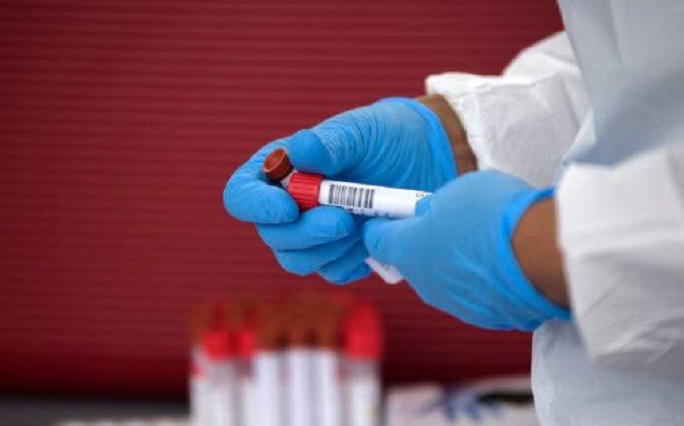 Covid-19 deve mudar hábitos de consumo