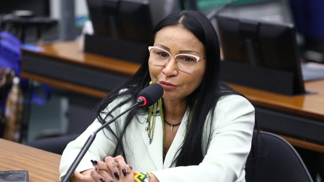 TSE mantém cassação de deputada do PL por uso de verba pública em harmonização facial