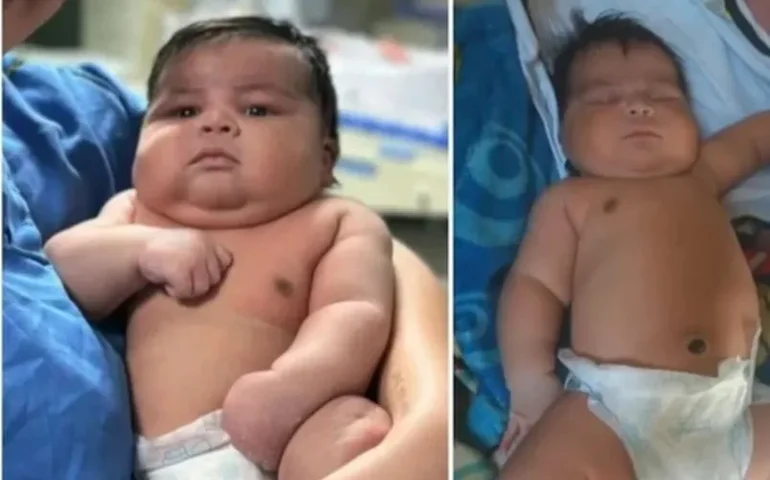 Bebê de 6,5 kg nasce de parto normal no Espírito Santo, e mãe leva 55 pontos após complicações