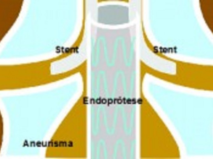 Técnica é utilizada em casos específicos