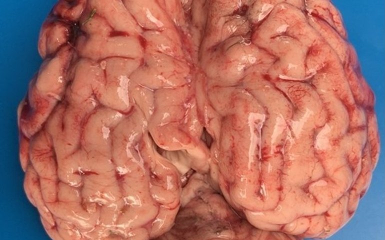 Cientistas recriam trecho de música do Pink Floyd a partir de ondas cerebrais; ouça e entenda o impacto na medicina