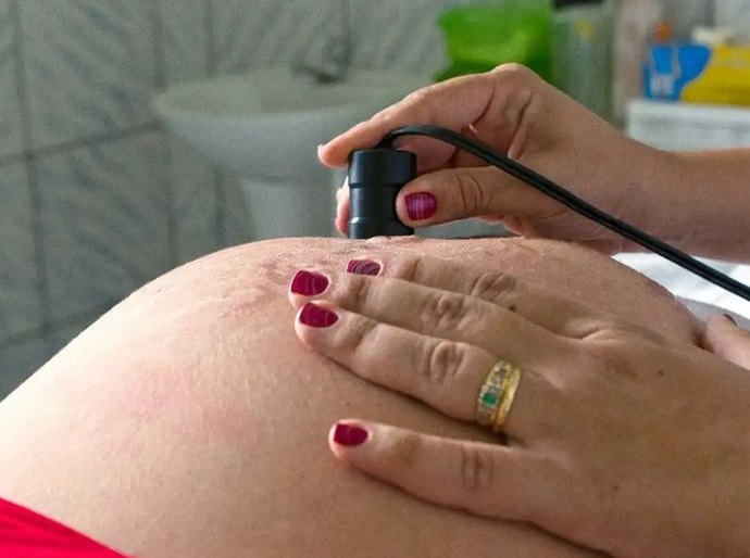 OMS: 300 mil mulheres morrem anualmente em razão de gravidez ou parto
