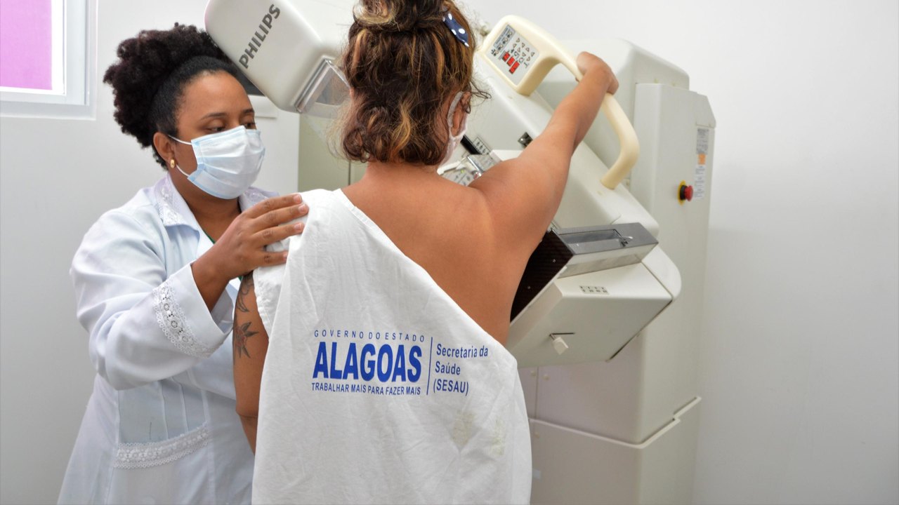 Unidades da Sesau oferecem exame de mamografia; saiba quais são e como agendar