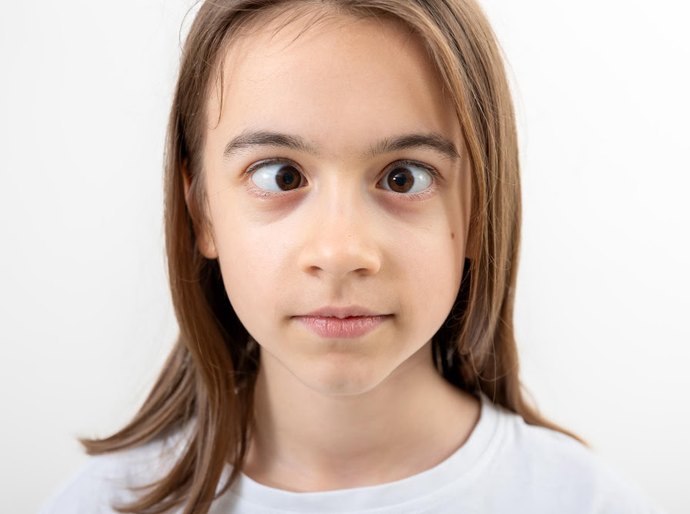 Fique atento se seus olhos diferem no tamanho, formato ou alinhamento