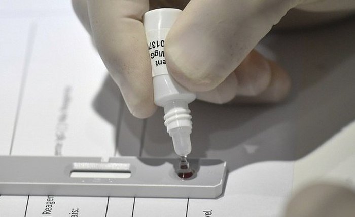 Teste rápido identifica se o paciente desenvolveu anticorpos contra o vírus