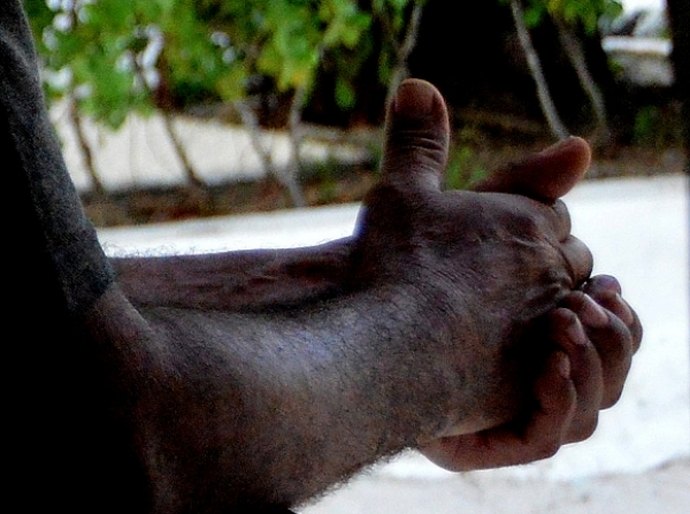 Sesau promove seminário para profissionais que atendem usuários de drogas