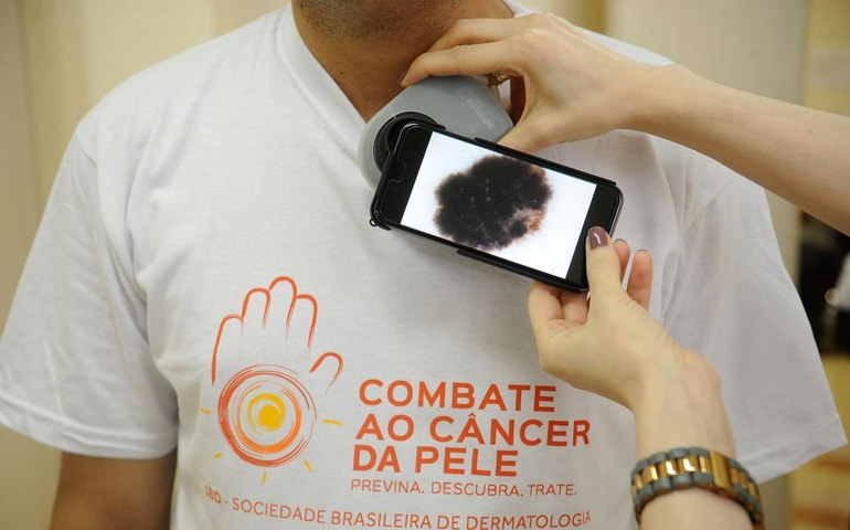 Mutirão atende população hoje, no dia de combate ao câncer de pele