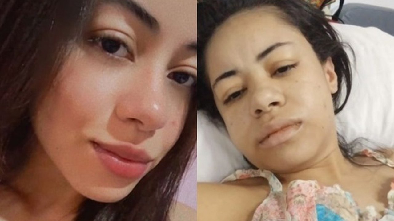 Jovem alagoana precisa de ajuda para custear tratamento de doença rara