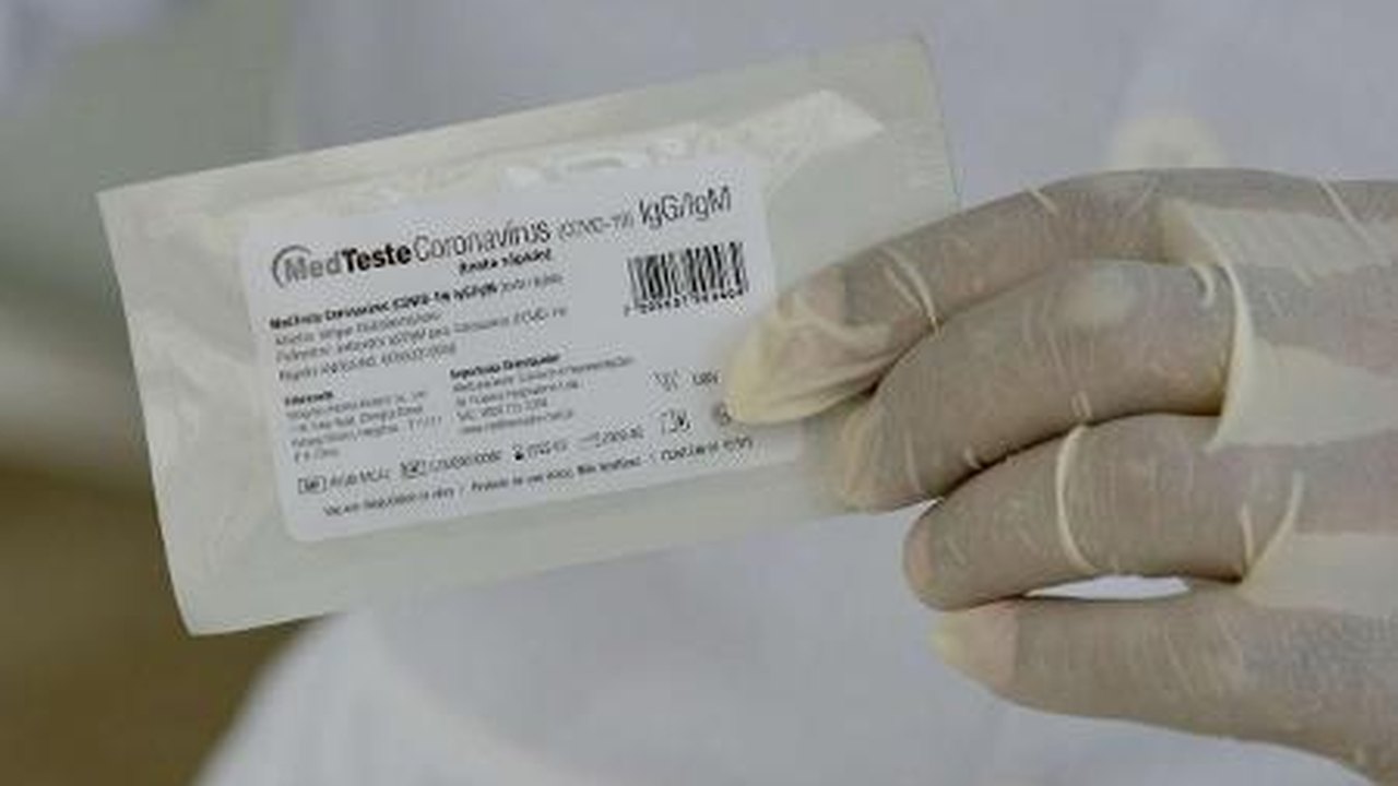 Em SP, 50% dos pacientes graves têm menos de 60 anos