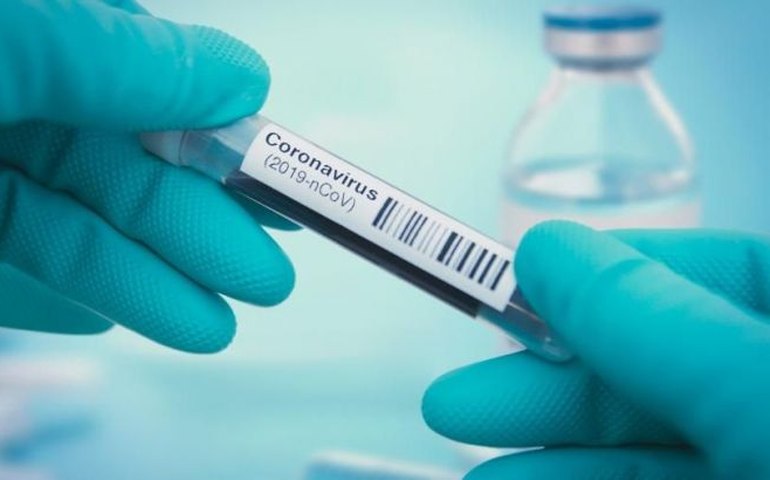 Governo de SP anuncia parceria com setor privado para testagem da covid-19
