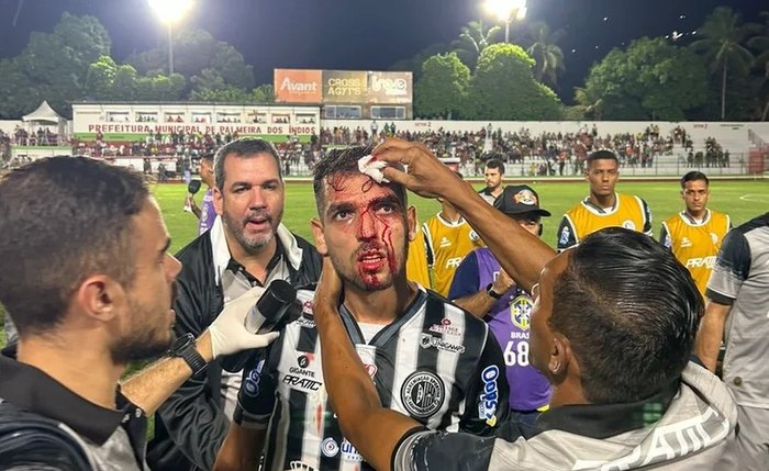 Alef foi agredido por torcedor do CSE