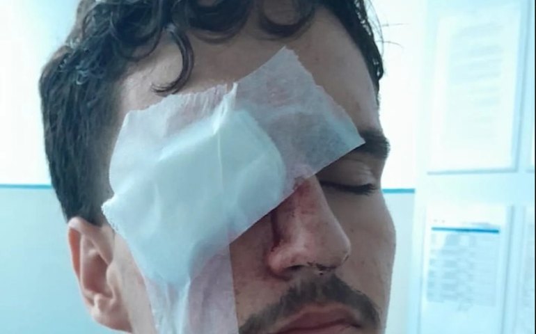 Torcedor do Vasco perde visão após ser atingido por bala de borracha em ação policial