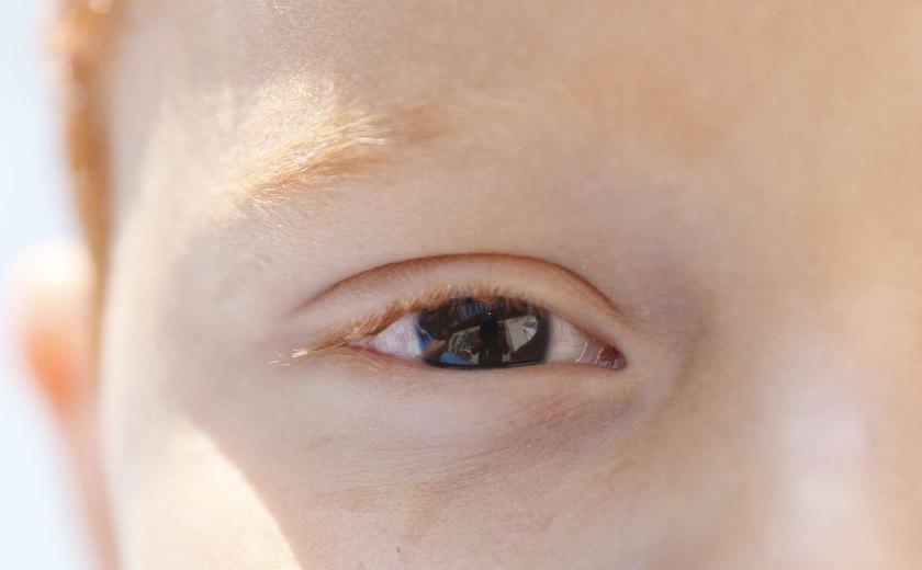 Cartilha sobre saúde ocular na infância orienta pais e professores