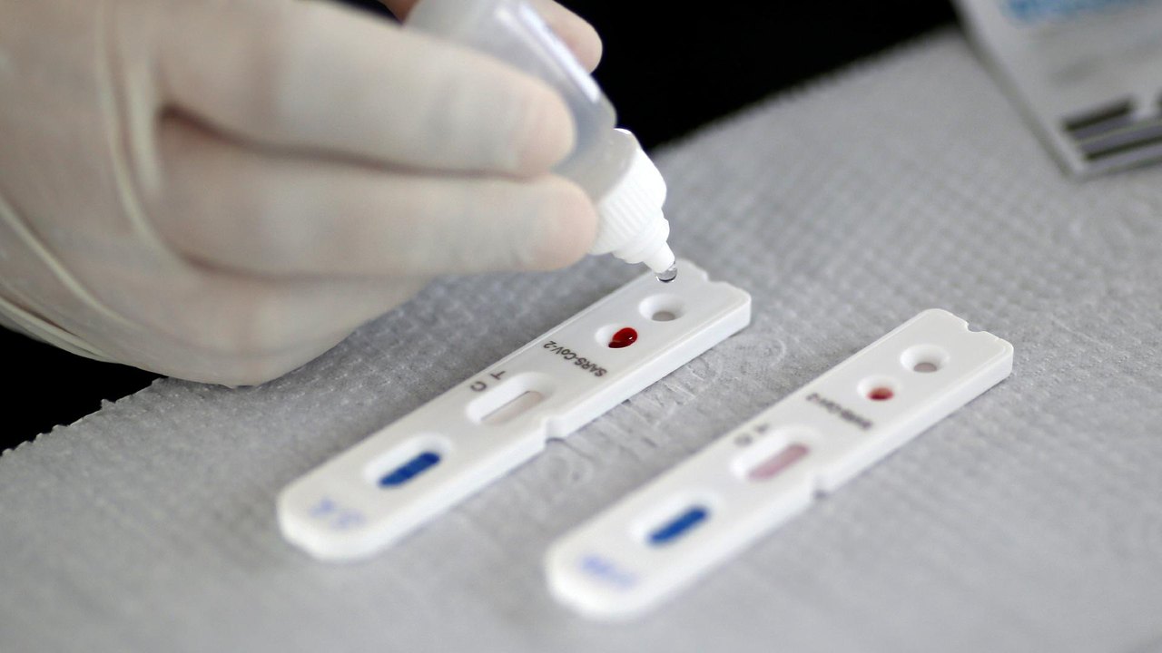 Universidade de Nevada confirma caso de reinfecção de coronavírus