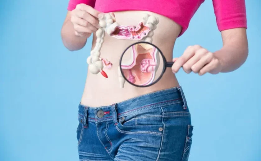 Câncer colorretal em jovens: estudo aponta as principais causas