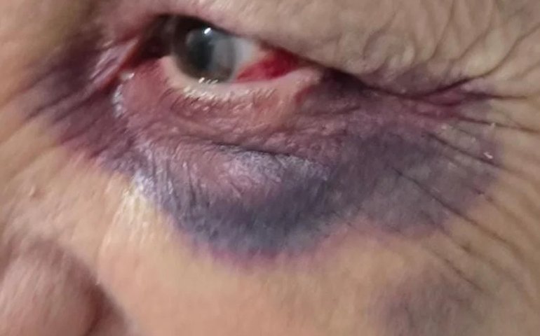 Dois homens são presos por violência doméstica em Palmeira dos Índios